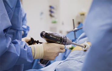 Gastric Bypass